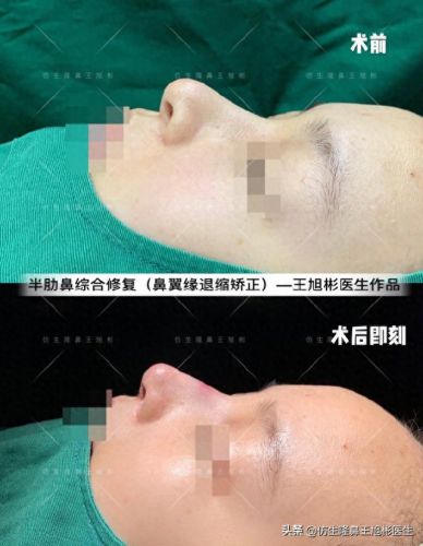 鼻高光十大排行榜(鼻影高光排行榜10强)插图7