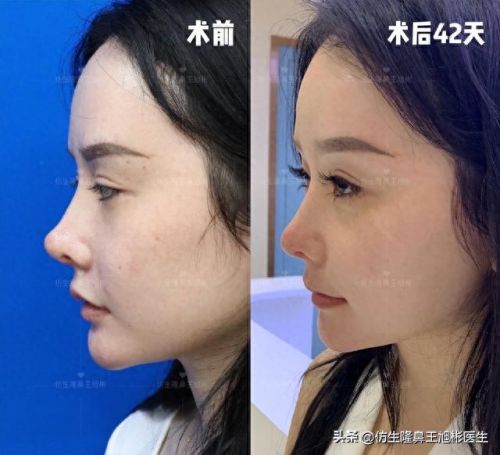 鼻高光十大排行榜(鼻影高光排行榜10强)插图3