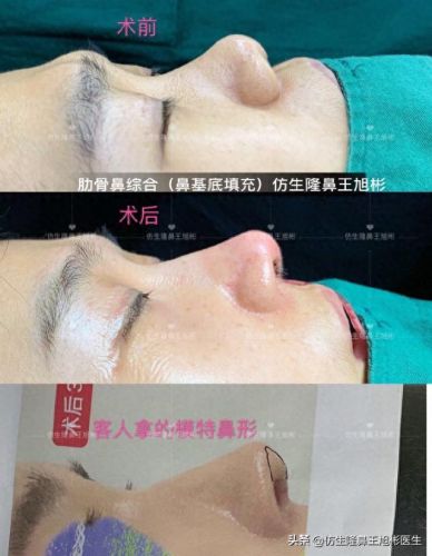 鼻高光十大排行榜(鼻影高光排行榜10强)