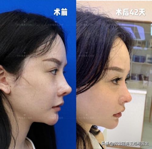 鼻高光十大排行榜(鼻影高光排行榜10强)插图2