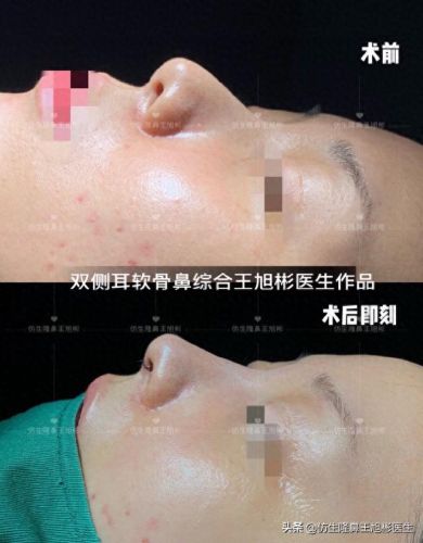 鼻高光十大排行榜(鼻影高光排行榜10强)插图6