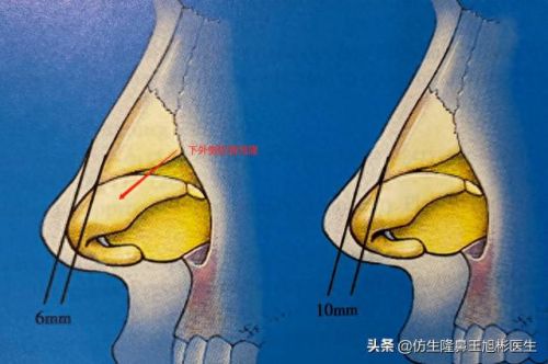 鼻高光十大排行榜(鼻影高光排行榜10强)插图1