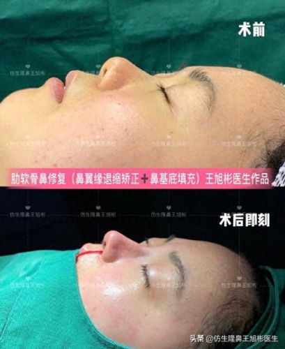 鼻高光十大排行榜(鼻影高光排行榜10强)插图4