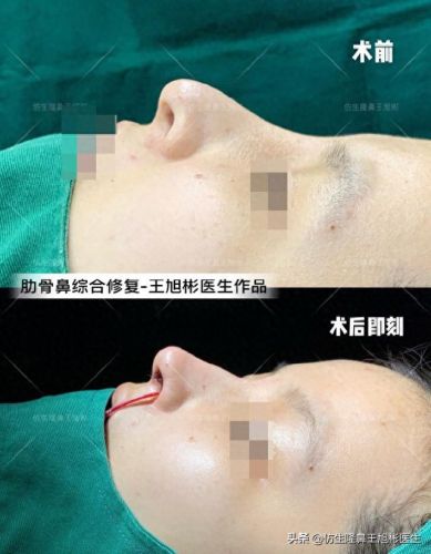 鼻高光十大排行榜(鼻影高光排行榜10强)插图5