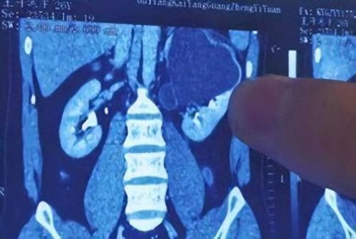人类手部力量排名前十(锻炼孩子手部肌肉力量)插图4