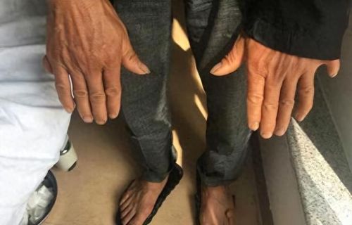 人类手部力量排名前十(锻炼孩子手部肌肉力量)