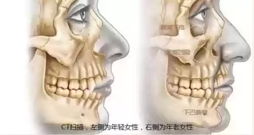 阵容脸骨头插图1